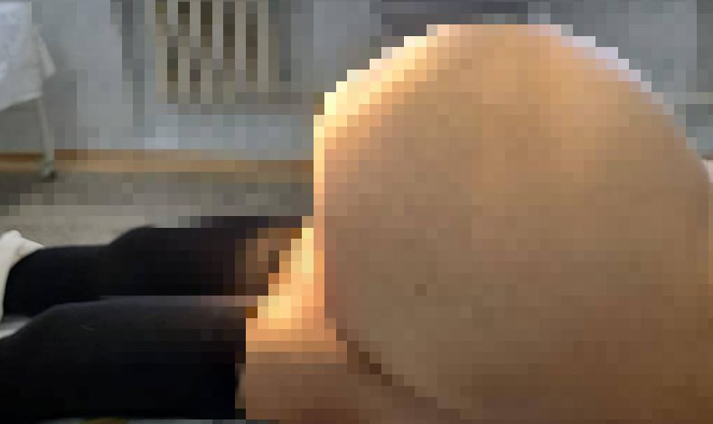 В Башкирии женщине удалили гигантскую опухоль и матку