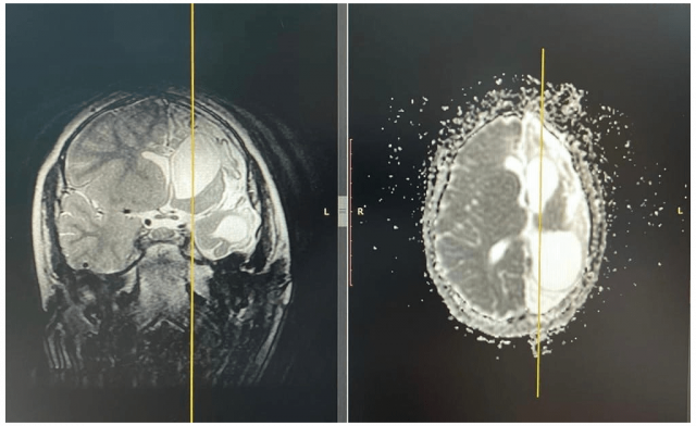 В Уфе пятилетнему ребенку провели редкую операцию
