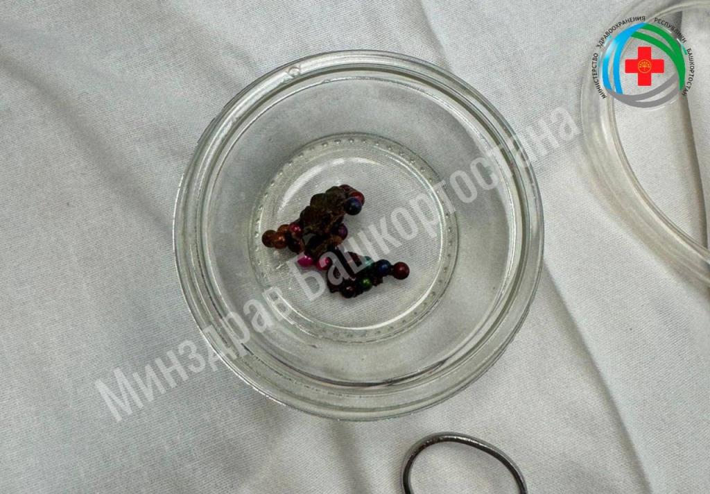 В Башкирии спасли 2-летнего малыша, проглотившего 26 магнитных шариков