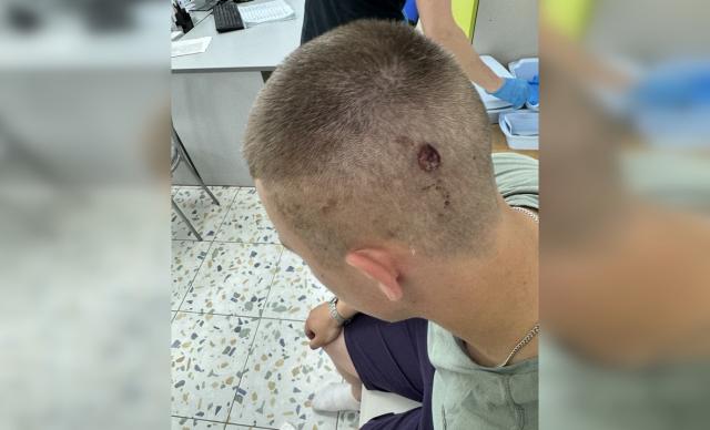 Бастрыкин взял на контроль дело о нападении на охранника-подростка в Уфе