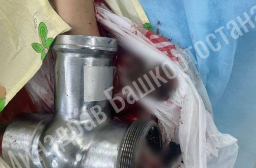 В Башкирии 4-летней девочке раздробило кисть в мясорубке