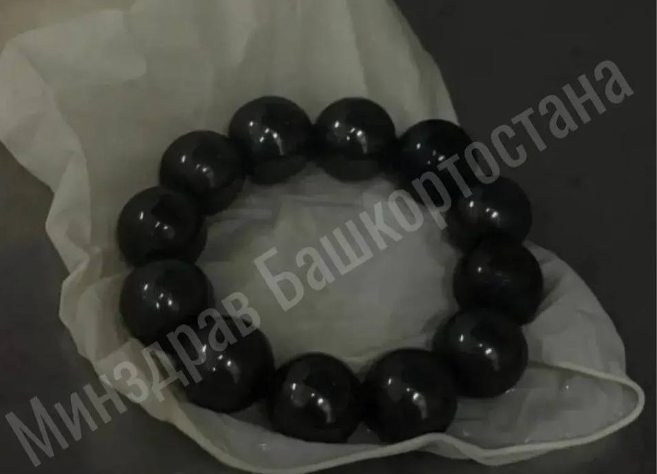 В Уфе хирурги спасли девочку, проглотившую магнитные шарики