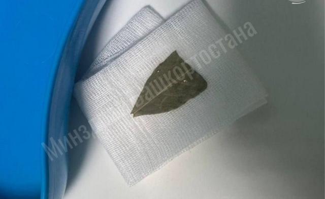 Врачи в Башкирии спасли пациентку, которая подавилась лавровым листом